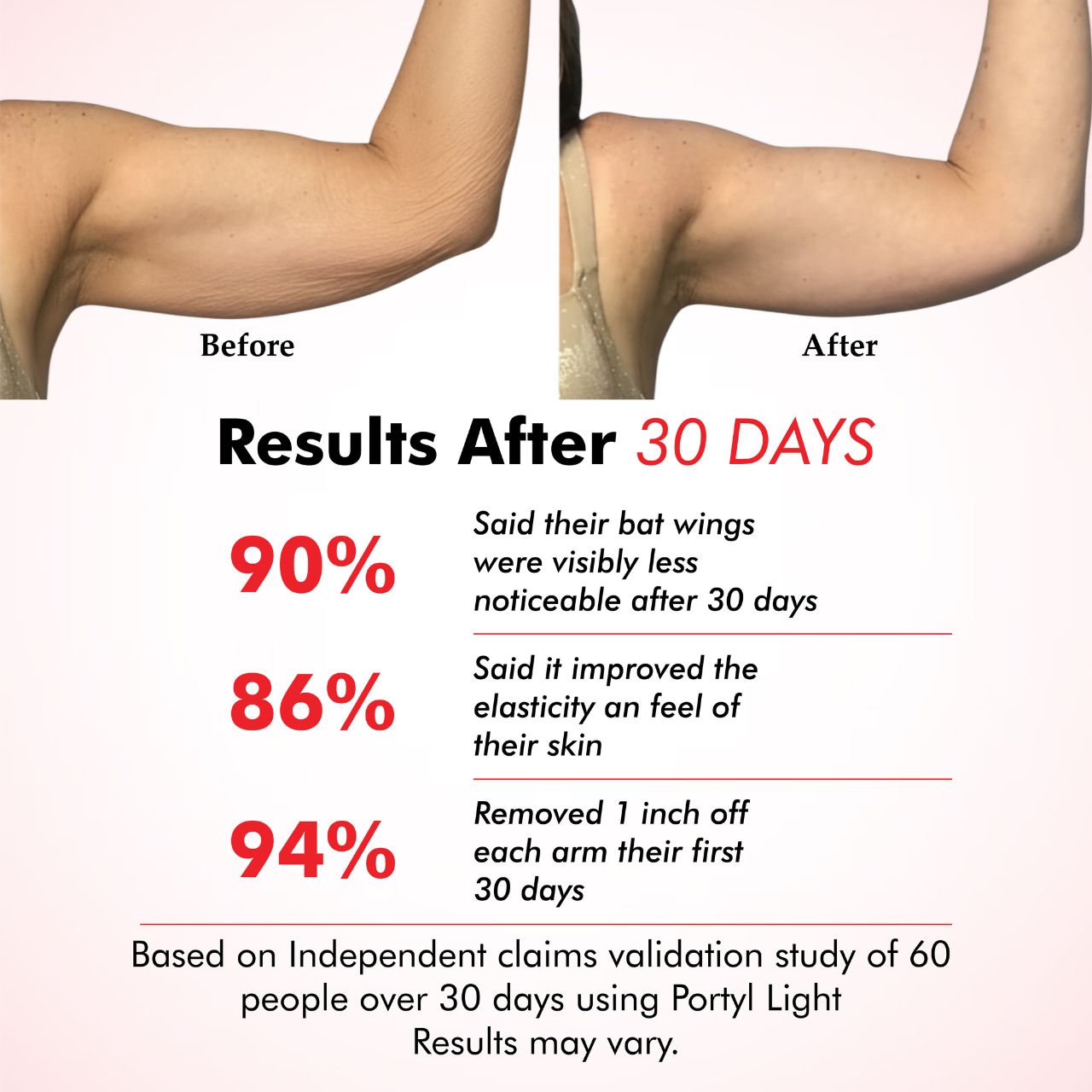 Portyl Light Arm Band