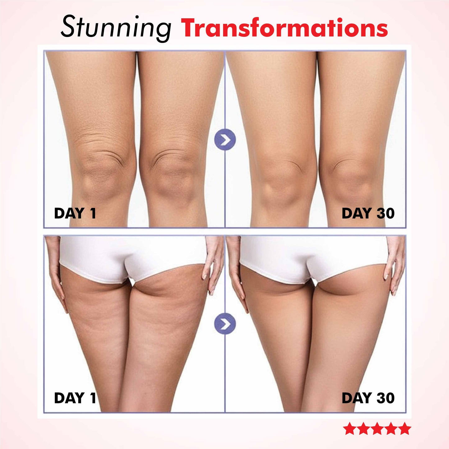 Potyl Light Thigh Band