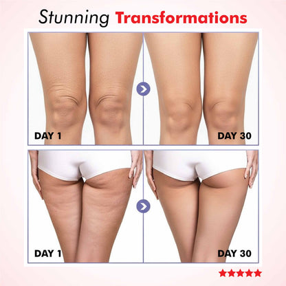 Potyl Light Thigh Band