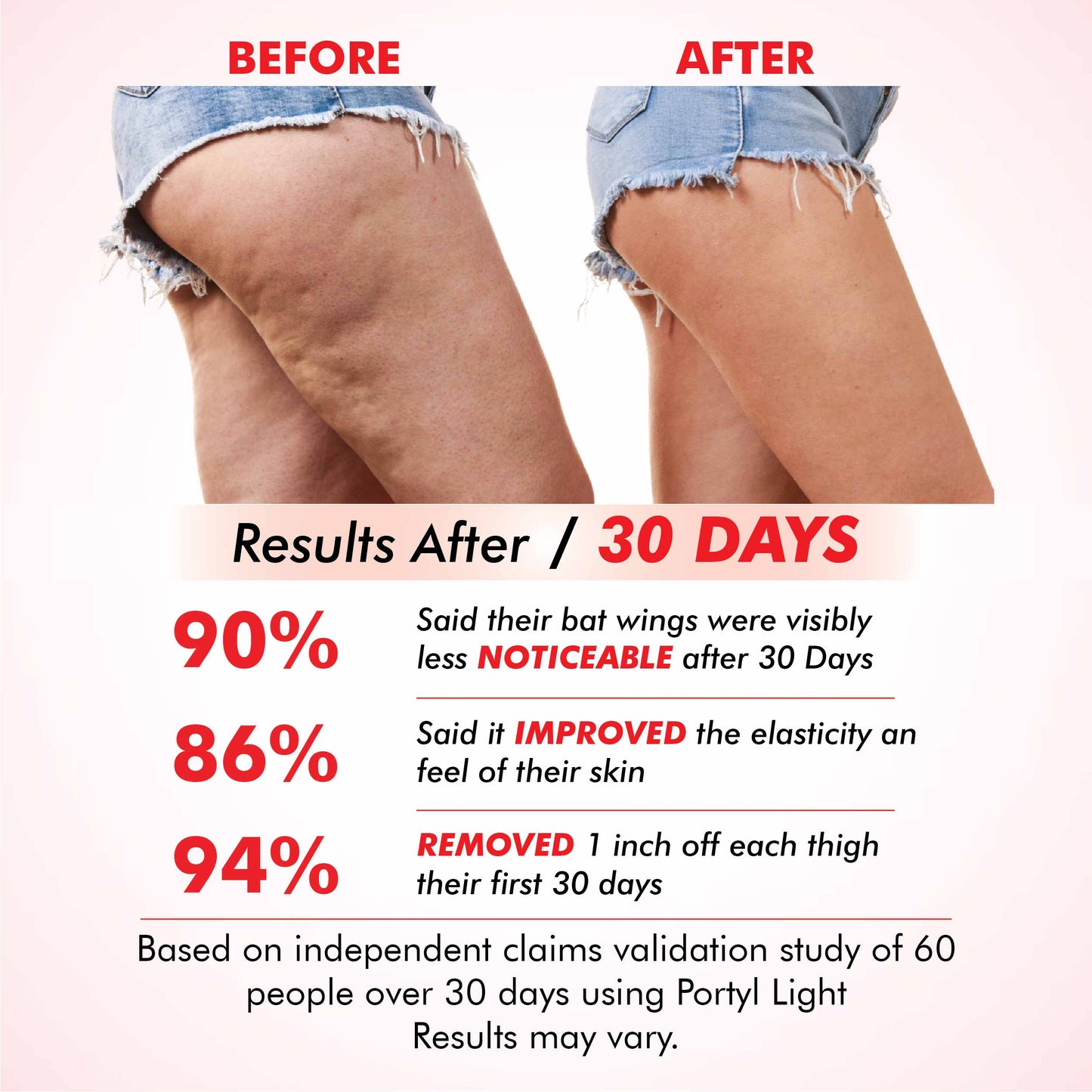 Potyl Light Thigh Band