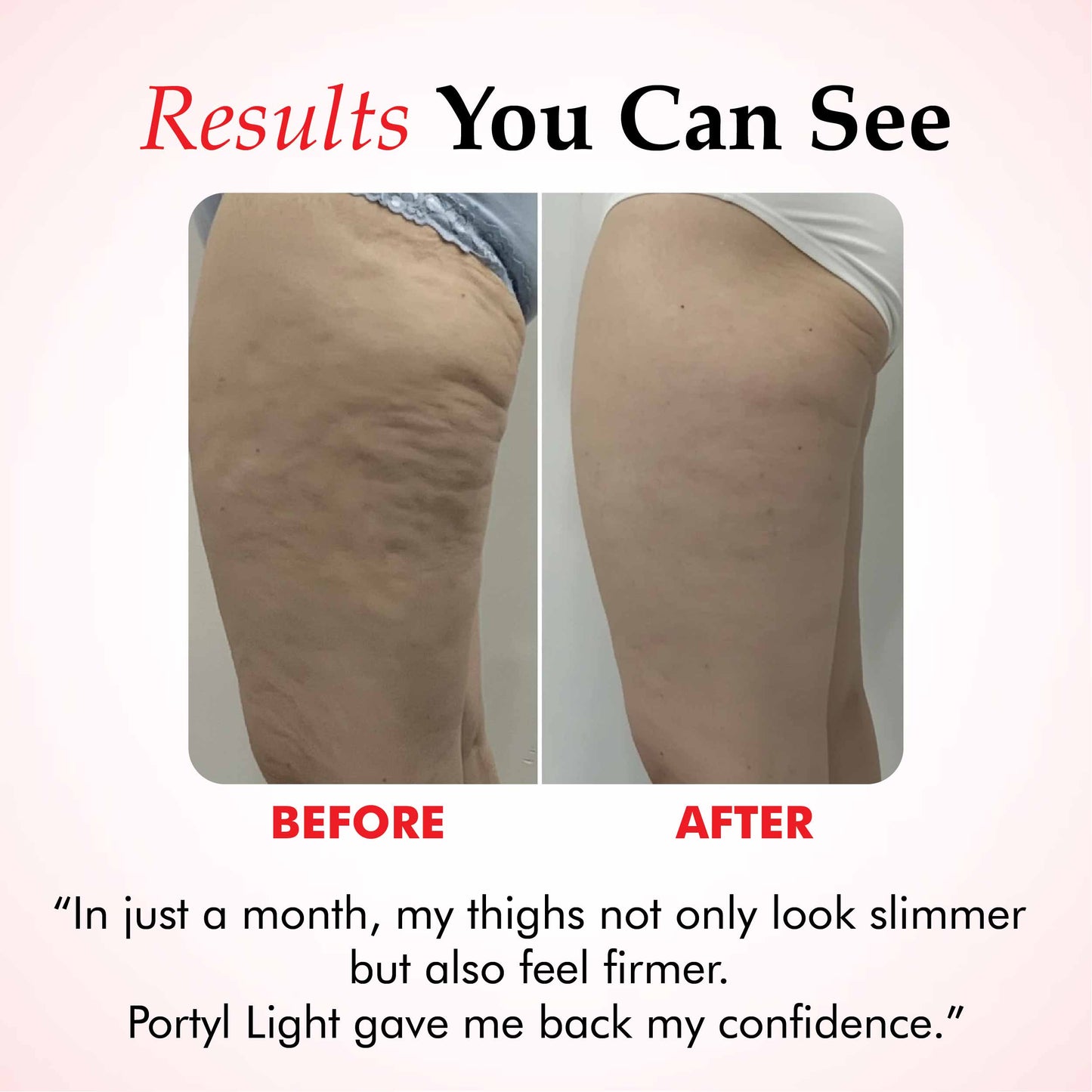 Potyl Light Thigh Band