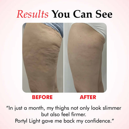 Potyl Light Thigh Band